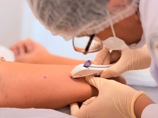 Oferta de Implanon Amplia o Acesso ao Planejamento Reprodutivo em Nova Cruz!